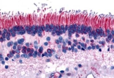 Immunohistochemistry-Paraffin: PTP mu/PTPRM Antibody [NBP3-14457] - Immunohistochemistry of formalin-fixed, paraffin-embedded human retina after heat-induced antigen retrieval.